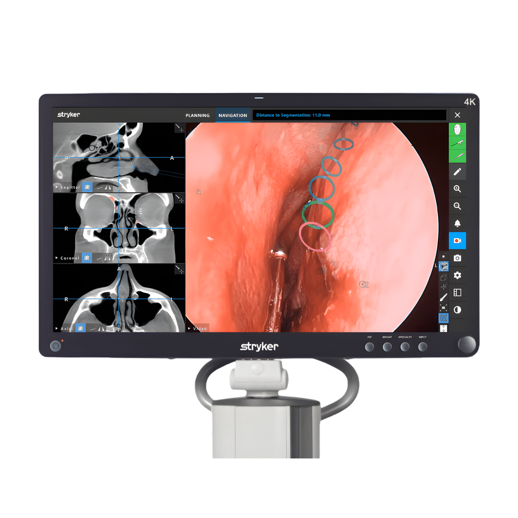 Stryker ENT Navigation System REF 8000-010-003 with Field Generator 8000-010-004 – advanced image-guided ENT surgical navigation equipment for sinus and skull base surgery by Stryker Medical