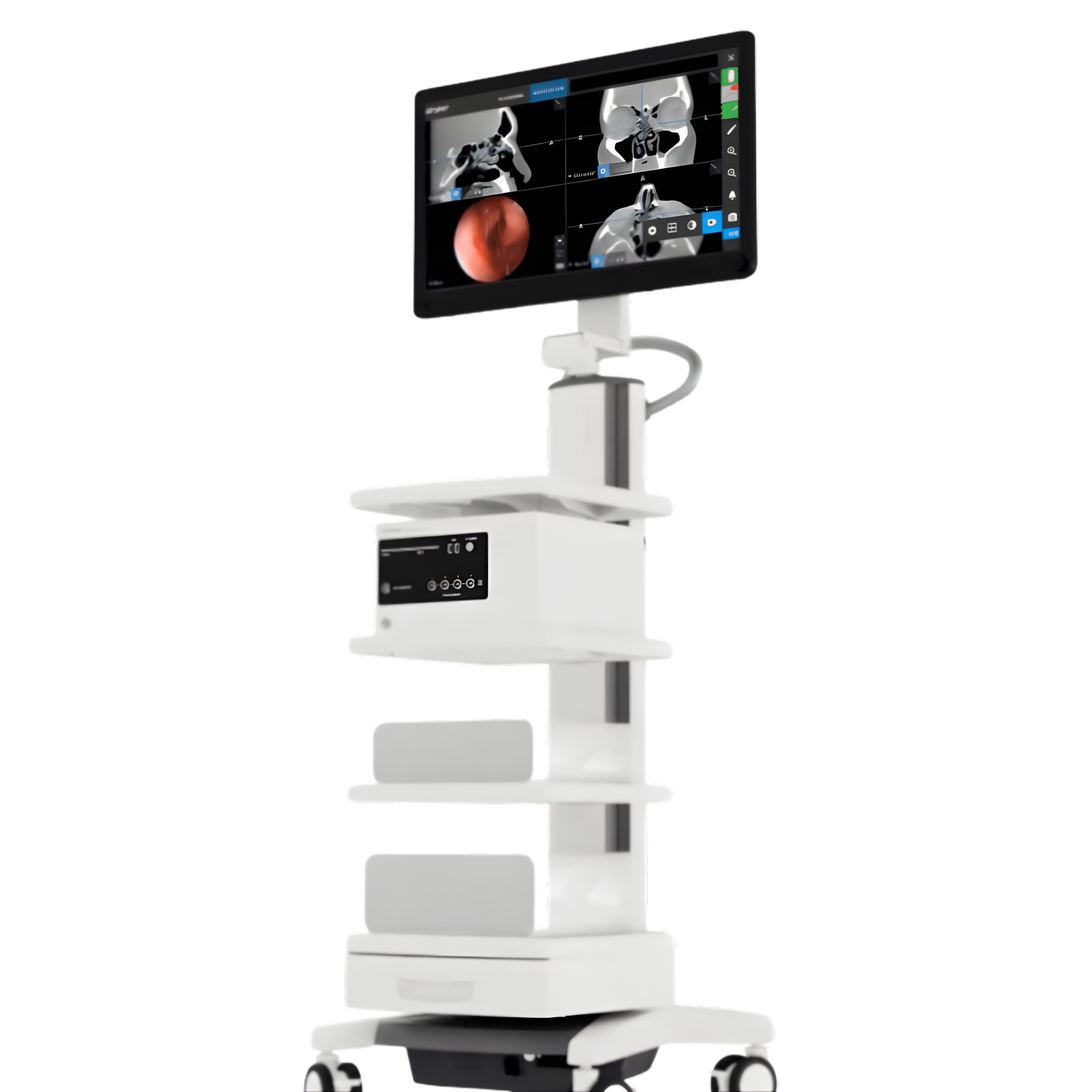 Stryker ENT Navigation System REF 8000-010-003 with Field Generator 8000-010-004 – advanced image-guided ENT surgical navigation equipment for sinus and skull base surgery by Stryker Medical