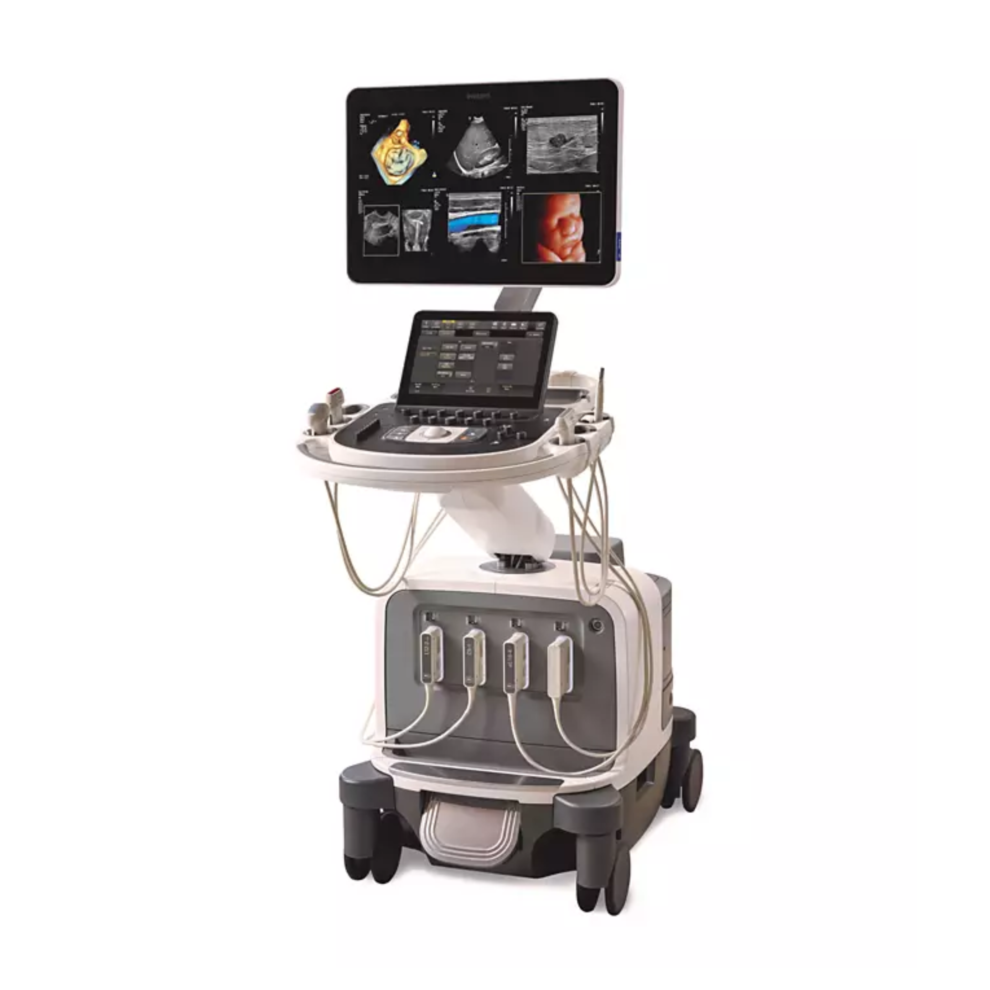 "Philips Epiq Elite-7G Premium Ultrasound Machine – Advanced Diagnostic Imaging System"
