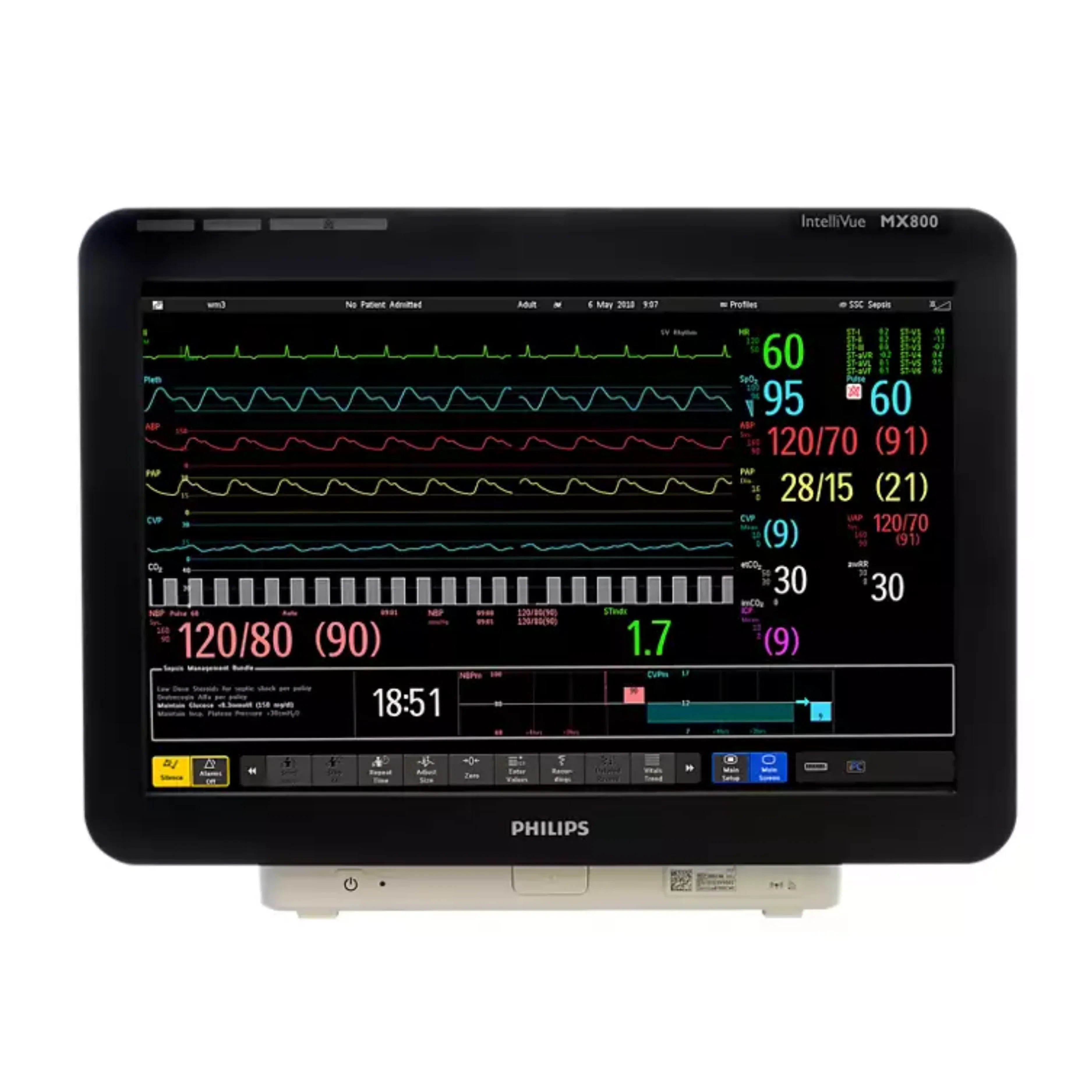 Philips IntelliVue MX800 Patient Monitor - Morf Medical